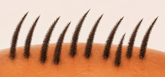 Les mêmes cheveux, plus épais et plus volumineux après l'application de Caboki